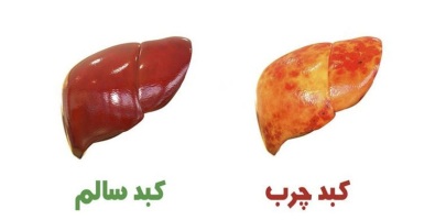 خواص بنه برای کبد چرب
